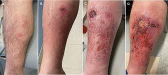 Inpatient Considerations in the Diagnosis and Management of ...