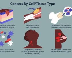 Different types of cancer