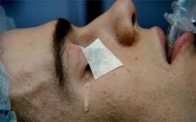 Image result for Anesthesia surgery