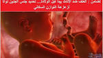 تحديد جنس الجنين يثير الجدل