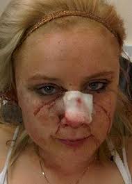 By JOHN COLES Published: Today THIS is bloodied Jenna Burns after being confronted by three louts and beaten unconscious for no reason. - SNN2825AA280_1318602a