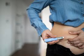 Dermatologic Outcomes of GLP-1 RA Use