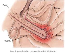 Image result for how to insert male organ into female organ