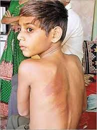 MUMBAI: Roshan Salunke, a class V student of Gayatri Vidyalaya, was beaten with a wooden stick on his hands, back and head by his teacher, Bhimrao Bhalerao, ... - 1004538