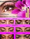 Grande Lash - MD Eyelash and Eyebrow Formula m