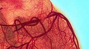 Image result for Regular coffee may have cleaner arteries