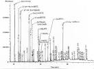 Weight loss, the gut and the inflammatory response in aids patients