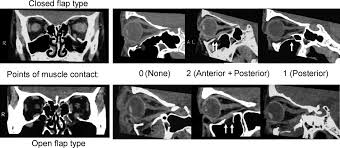 pemeriksaan radiology kepala