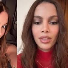 Anitta Surpreende! Cirurgião Revela Segredos da Transformação no Rosto!