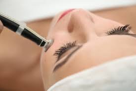 Resultado de imagem para peeling de diamante