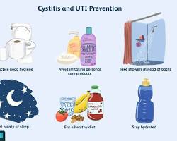 Image of Cystitis prevention methods