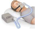 Ventilatori polmonari pneumatici e CPAP - Medicoimpianti