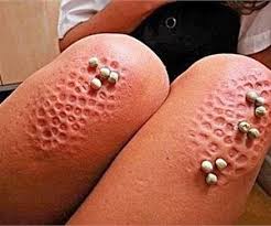 Image result for Miniature Nuclear weapons 4