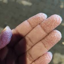 Washerwoman's Hands. And feet too. After only six hours of ...