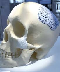 ceramics #medtech #materials #industrial #technical ...