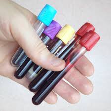 Image result for medical laboratory blood sample