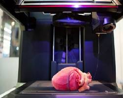 Imagen de Impresión 4D de un implante médico