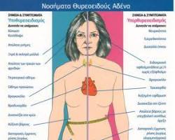 Εικόνα Συμπτώματα θυρεοειδίτιδας Χασιμότο