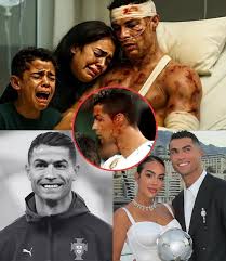 SAD NEWS: Just 30 minutes ago, reports confirm Cristiano Ronaldo, 40, was seriously injured in a brutal attack—his family shares the heartbreaking news. The football legend, known for his resilience both on