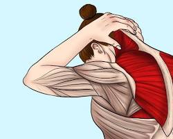 Hình ảnh về Kéo căng cơ cổ vai gáy