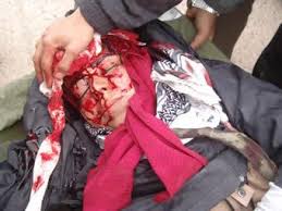 Image result for ‫کشتار 19 فروردین در اشرف‬‎