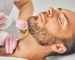 laser depilation procedure