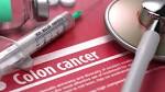  Colon cancer screening should start earlier, American Cancer Society says