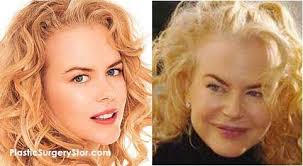 Image result for evil eyebrows botox