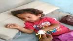 ابين..وباء الحصبة يهدد الاطفال وحكومة