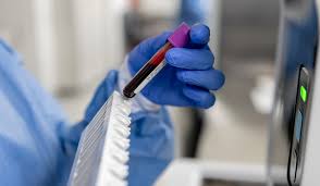 Column | I’m an oncologist. Every man should know this about prostate cancer.