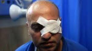 Image result for PALESTINIAN photojournalist NIDAL ESHTAYEH PHOTO