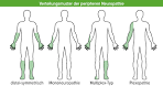 Polyneuropathie: Beschreibung mehr