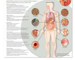 Image of IBD anatomy diagram