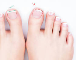 Image of Trimming and shaping toenails