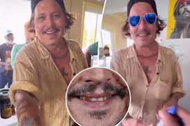 johnny depp teeth