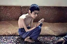 Image result for starving people