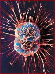 תוצאת תמונה עבור مرض السرطان