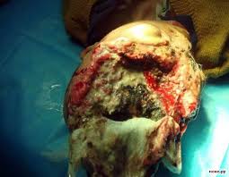 Image result for vibrio vulnificus china