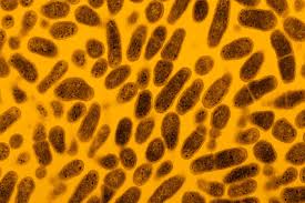 The Effect of Vaginal Sex on the Microbiome of the Penis