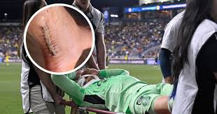 “Sólo Dios sabe por qué”: Luis Ángel Malagón muestra el resultado de su operación