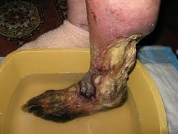 Resultado de imagem para Krokodil pictures