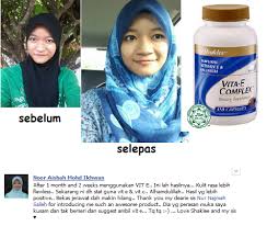 Image result for image testimoni jerawat shaklee