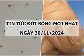 Tin tức đời sống 30/11/2024: Hãi hùng rận bám chi chít trên mi mắt người phụ nữ