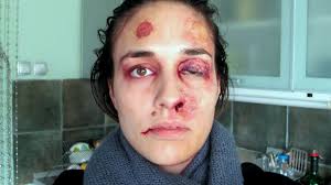 Resultado de imagem para violencia contra mulher