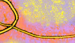  New Breakthrough Paving the Way for Universal Ebola Therapeutic