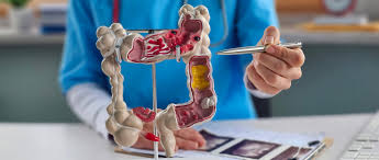 Colorectal Cancer : ce qu'il faut savoir — image 4