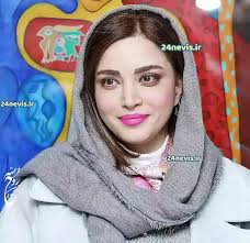 عکس/ تغییر شوکه کننده چهره بهنوش طباطبایی بعد از عمل زیبایی
