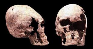 Résultat de recherche d'images pour "elongated skulls"