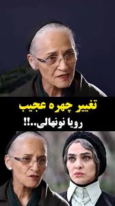 ماجرای تغییر چهره «رویا نونهالی» چیست؟|فرارو