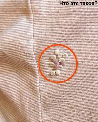 Лучшая - Я чуть не получила сердечный приступ, когда обнаружила в своей постели эти крошечные шарики. Вот что это оказалось на самом деле. Узнайте подробности здесь 👇 | Facebook